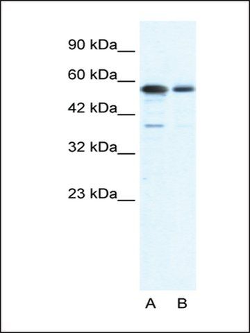 Anti-G22P1 (AB1) antibody produced in rabbit