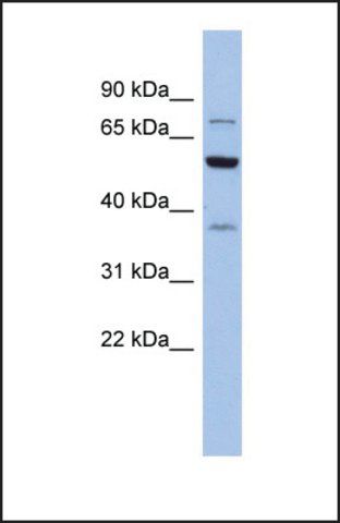 Anti-GARS antibody produced in rabbit