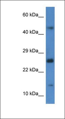 Anti-GABARAPL2 antibody produced in rabbit