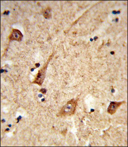 ANTI-GALNT2 (N-TERM) antibody produced in rabbit