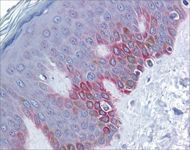 Anti-FZD5 antibody produced in rabbit