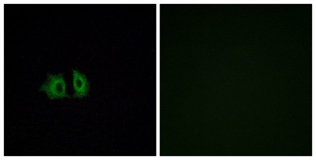 Anti-FZD5 antibody produced in rabbit