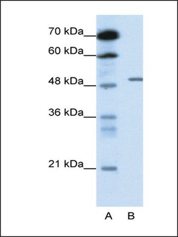 Anti-GABRB2 (AB1) antibody produced in rabbit