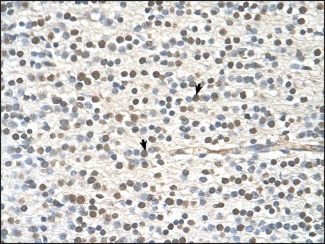 Anti-GAPVD1 antibody produced in rabbit