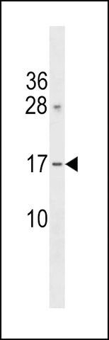 ANTI-GAPT (CENTER) antibody produced in rabbit