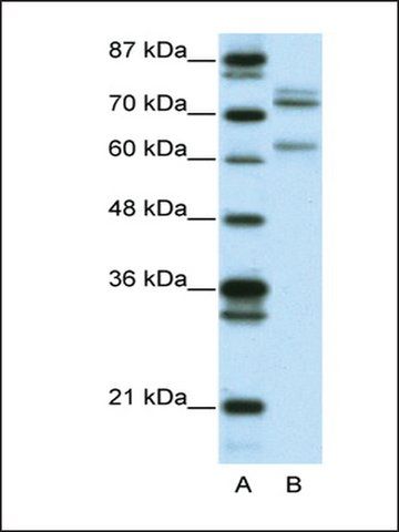 Anti-GATAD2B (AB1) antibody produced in rabbit