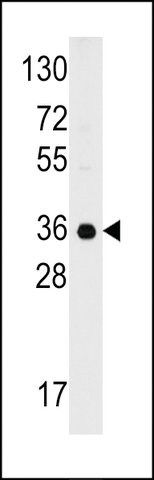 ANTI-GC1QR (C1QBP)(C-TERMINAL) antibody produced in rabbit