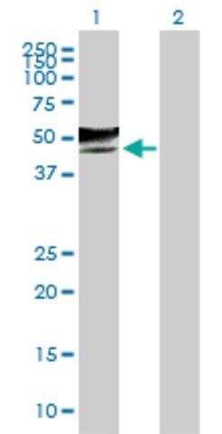 Anti-GCNT2 antibody produced in mouse