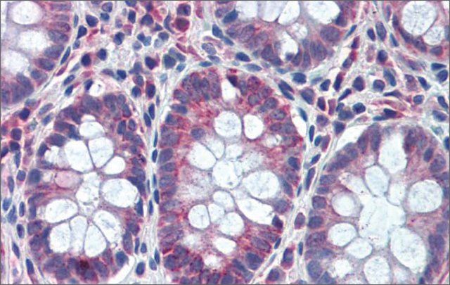 Anti-GATA6 (ab2) antibody produced in rabbit