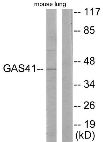 Anti-GAS41, N-Terminal antibody produced in rabbit