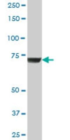 Anti-GBE1 antibody produced in mouse