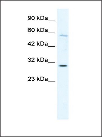 Anti-GATAD1 antibody produced in rabbit