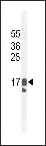 ANTI-GCDFP-15(C-TERMINAL) antibody produced in rabbit