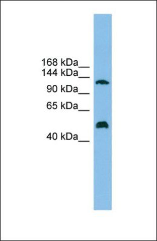 Anti-GART antibody produced in rabbit