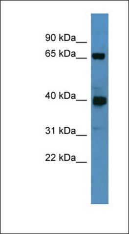 Anti-GALNT11 antibody produced in rabbit