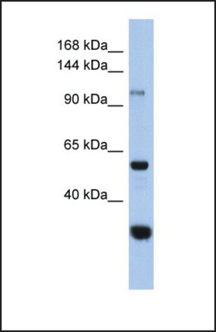 Anti-GANC antibody produced in rabbit