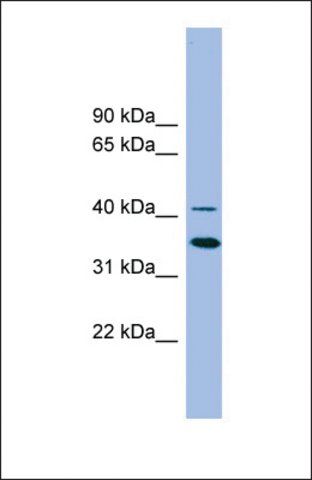 Anti-GATA5 antibody produced in rabbit