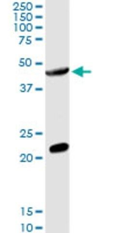 Anti-GCNT2 antibody produced in rabbit