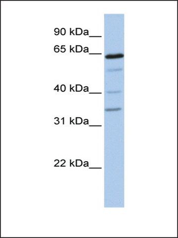 Anti-GALNTL1 antibody produced in rabbit