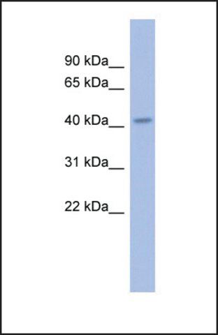 Anti-GBX2 antibody produced in rabbit