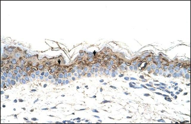 Anti-GEM antibody produced in rabbit