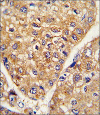 ANTI-GARP (CENTER) antibody produced in rabbit