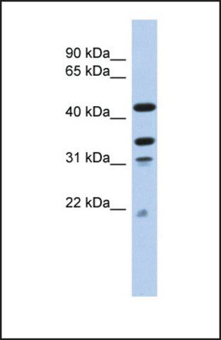 Anti-GATAD2A, (N-terminal) antibody produced in rabbit