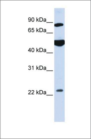 Anti-GCS1 antibody produced in rabbit