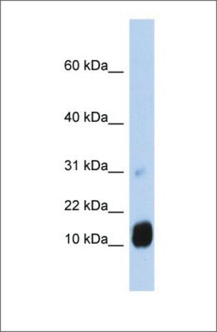 Anti-GCHFR antibody produced in rabbit