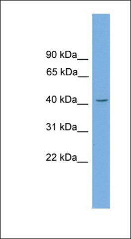 Anti-GATA5 antibody produced in rabbit