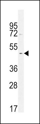 ANTI-GDPD5 (CENTER) antibody produced in rabbit