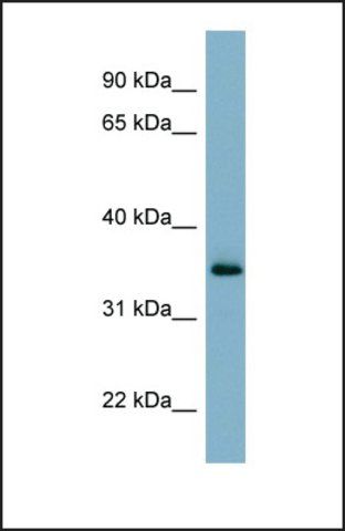 Anti-GEM, (N-terminal) antibody produced in rabbit