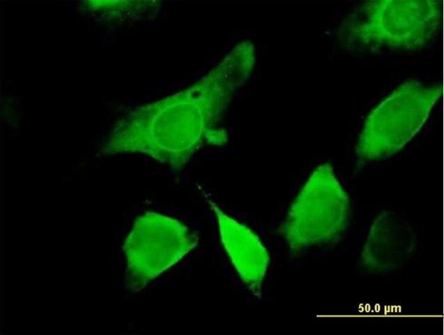 Anti-GEMIN6 antibody produced in mouse