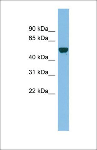 Anti-GDAP2, (N-terminal) antibody produced in rabbit