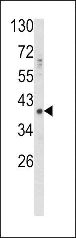 ANTI-GDF1(N-TERMINAL) antibody produced in rabbit