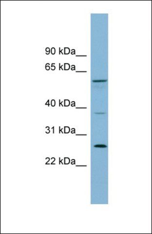 Anti-GDAP2, (N-terminal) antibody produced in rabbit