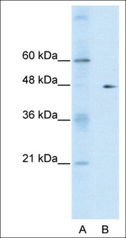 Anti-GDI2 antibody produced in rabbit