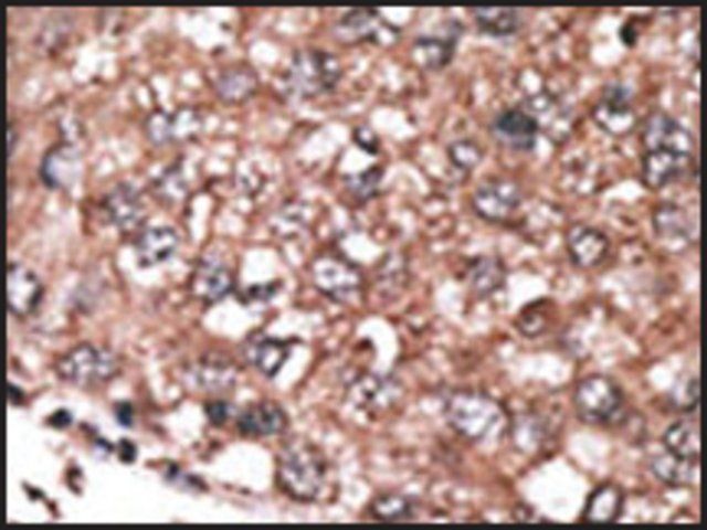 Anti-HAND2 (C-term) antibody produced in rabbit