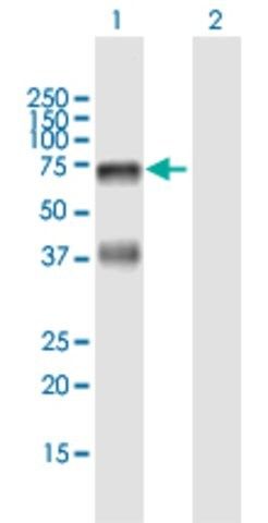 Anti-HABP2 antibody produced in mouse