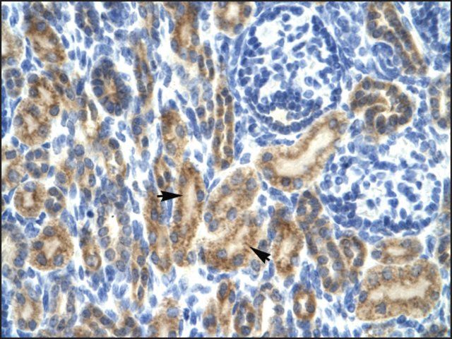 Anti-HCLS1 (AB1) antibody produced in rabbit