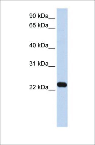 Anti-HBXIP antibody produced in rabbit