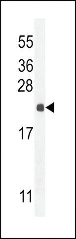 ANTI-HCG_2024410(C-TERMINAL) antibody produced in rabbit