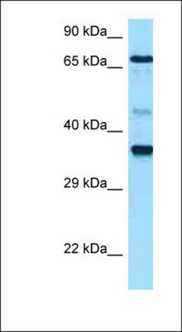 Anti-HAS1 antibody produced in rabbit