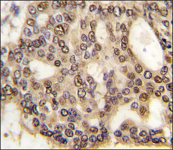 Anti-HDGF (C-term) antibody produced in rabbit