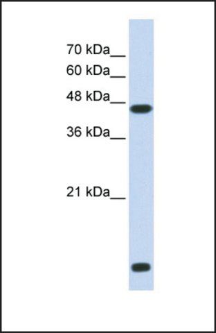 Anti-HDAC8, (N-terminal) antibody produced in rabbit