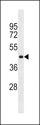 ANTI-HHCM(C-TERMINAL) antibody produced in rabbit