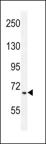 ANTI-HCG_17324 (C-TERM) antibody produced in rabbit