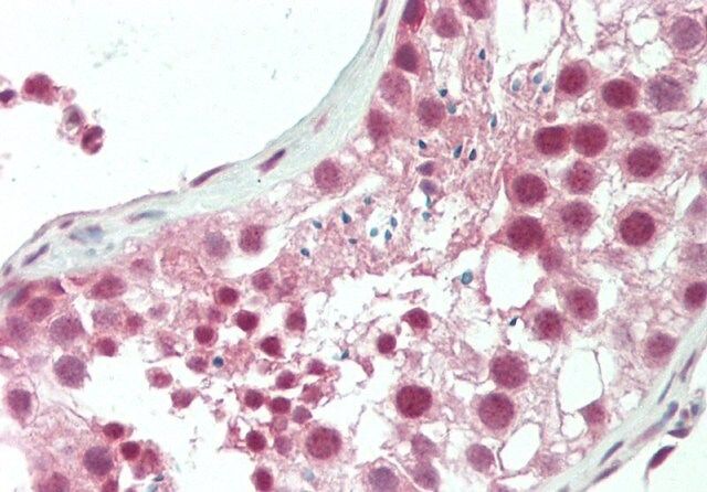 Anti-HERC5, (N-terminal) antibody produced in rabbit