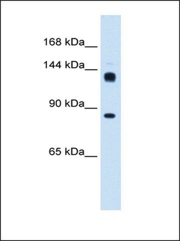 Anti-HB antibody produced in rabbit