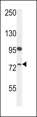 ANTI-HFM1 (C-TERM) antibody produced in rabbit